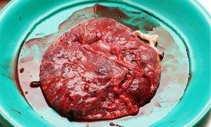 placenta-umana300x180