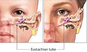 tromba di Eustachi-300x180