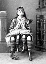5 persone con arti di troppo-Myrtle Corbin-180x250