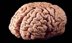 Corpo umano-il cervello-300x180